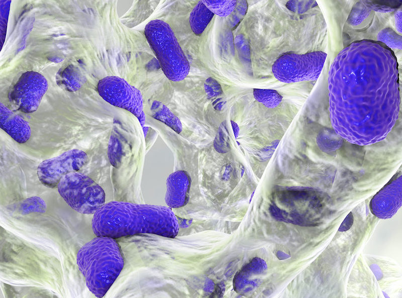 A Comprehensive Guide to Biofilms